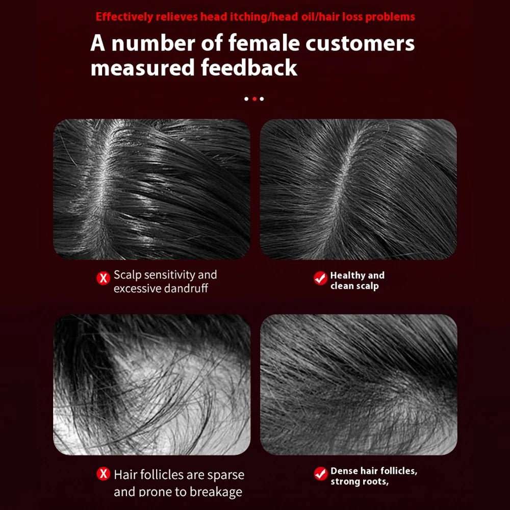 Lulupurest™ 3-in-1 Electric Scalp Massage Comb