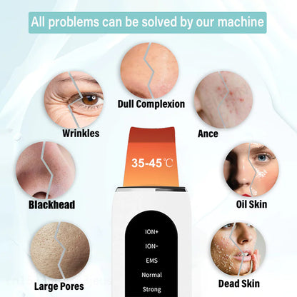 Lulupurest™ Ultrasonic Beauty Device