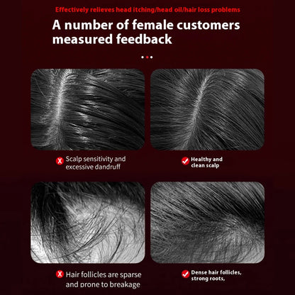 Lulupurest™ 3-in-1 Electric Scalp Massage Comb