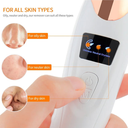 Lulupurest™ Vacuum Blackhead Remover &amp; Facial Pore Cleaner