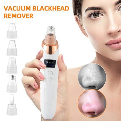 Lulupurest™ Vacuum Blackhead Remover &amp; Facial Pore Cleaner