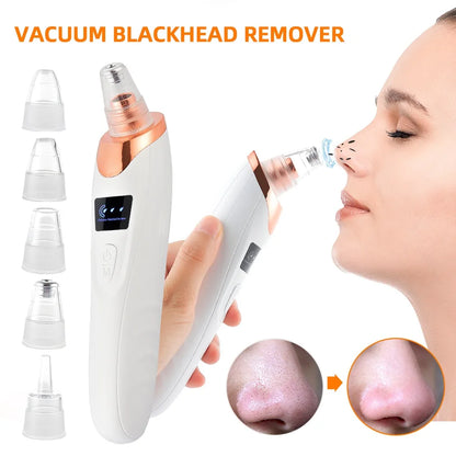 Lulupurest™ Vacuum Blackhead Remover &amp; Facial Pore Cleaner
