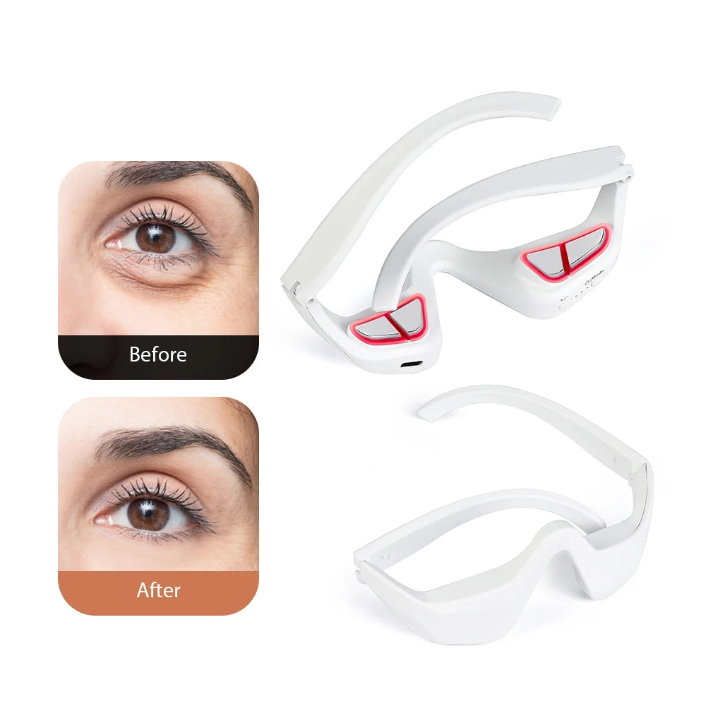 Lulupurest™ 3D Eye Massager for Fatigue &amp; Dark Circles