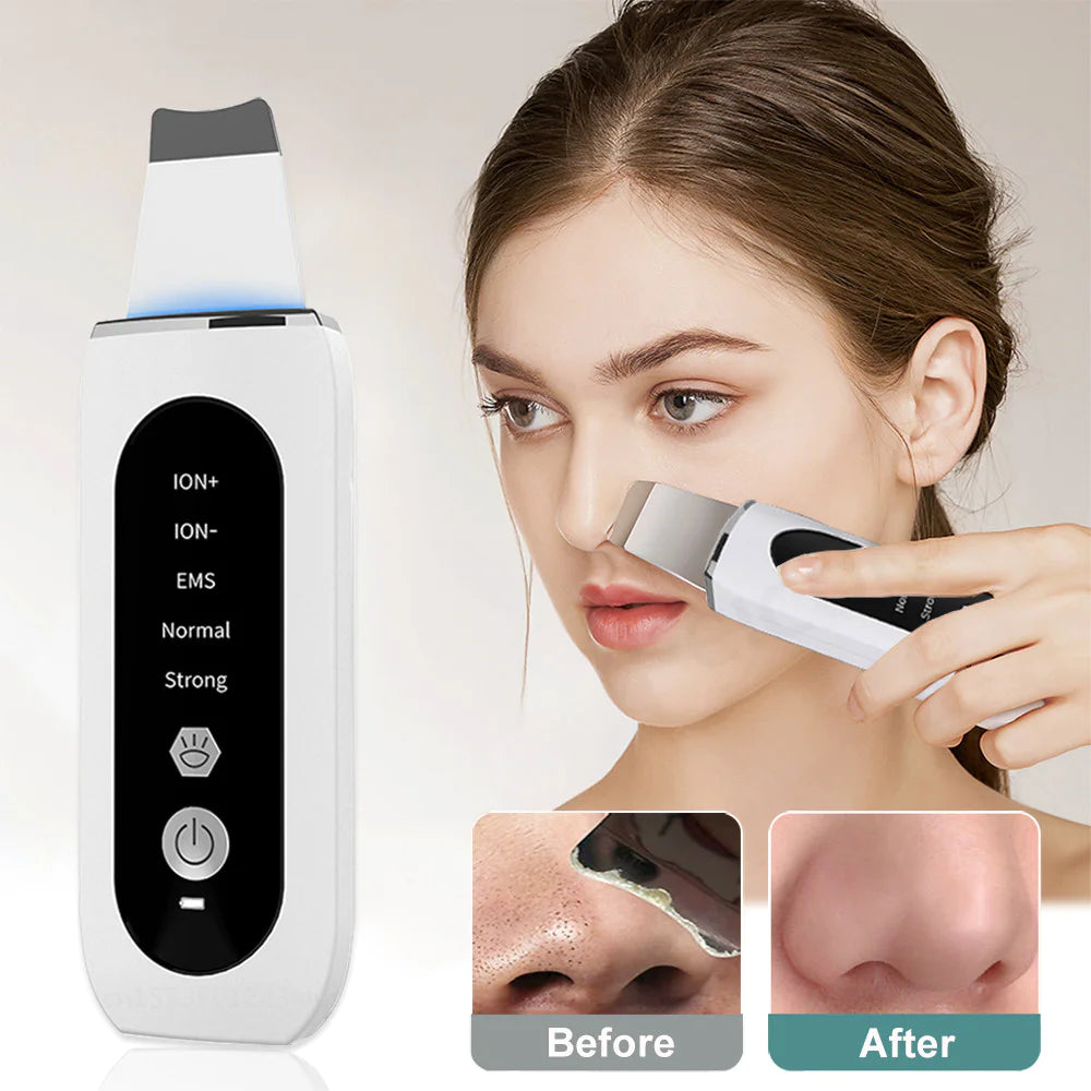 Lulupurest™ Ultrasonic Beauty Device